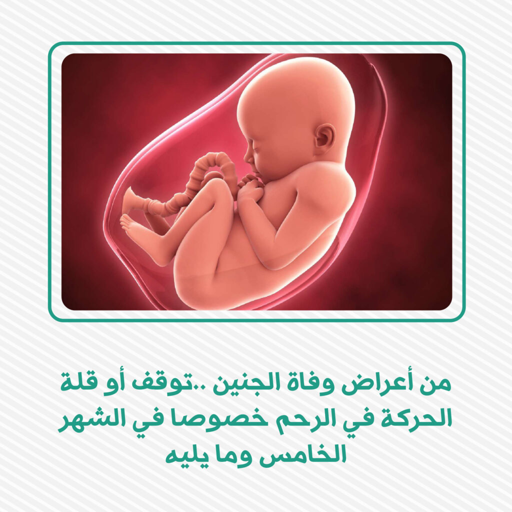 من أعراض وفاة الجنين